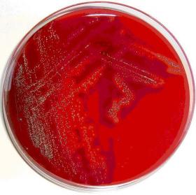 Τρυβλία Blood Agar