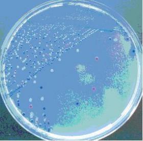 Τρυβλία CHROMagar E coli 0157