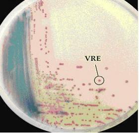 Τρυβλία CHROMagar ENETROCOCCUS